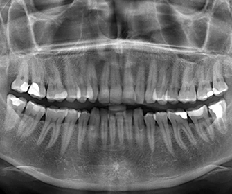 Ортопантомограмма